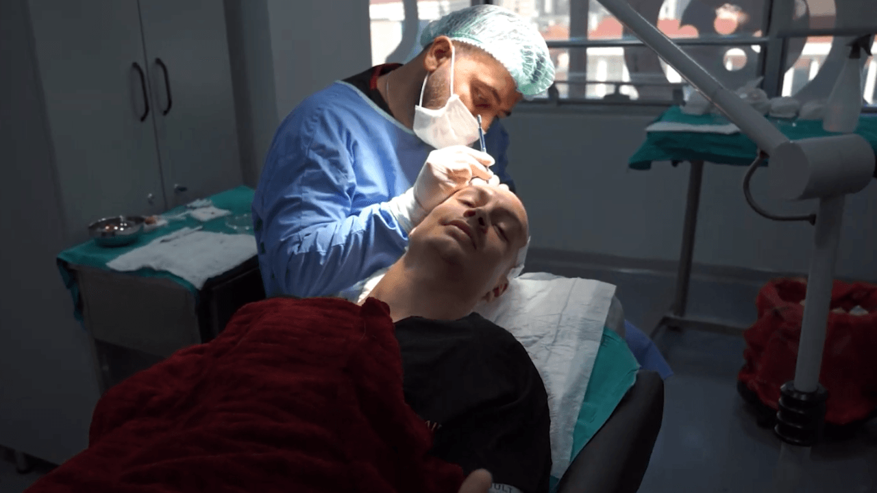Rôle des hormones dans la chute de cheveux