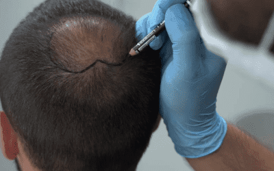 Les effets de la pollution sur les cheveux et le cuir chevelu
