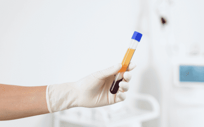 PRP: un traitement naturel pour renforcer vos cheveux
