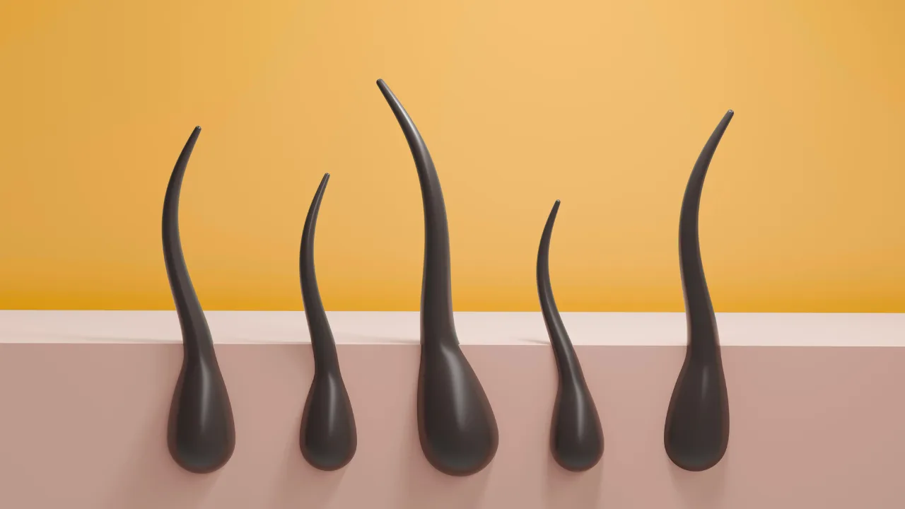 greffe cheveux bouclés