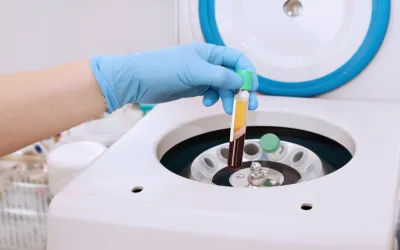 La médecine régénérative pour les cheveux : une nouvelle ère contre la chute