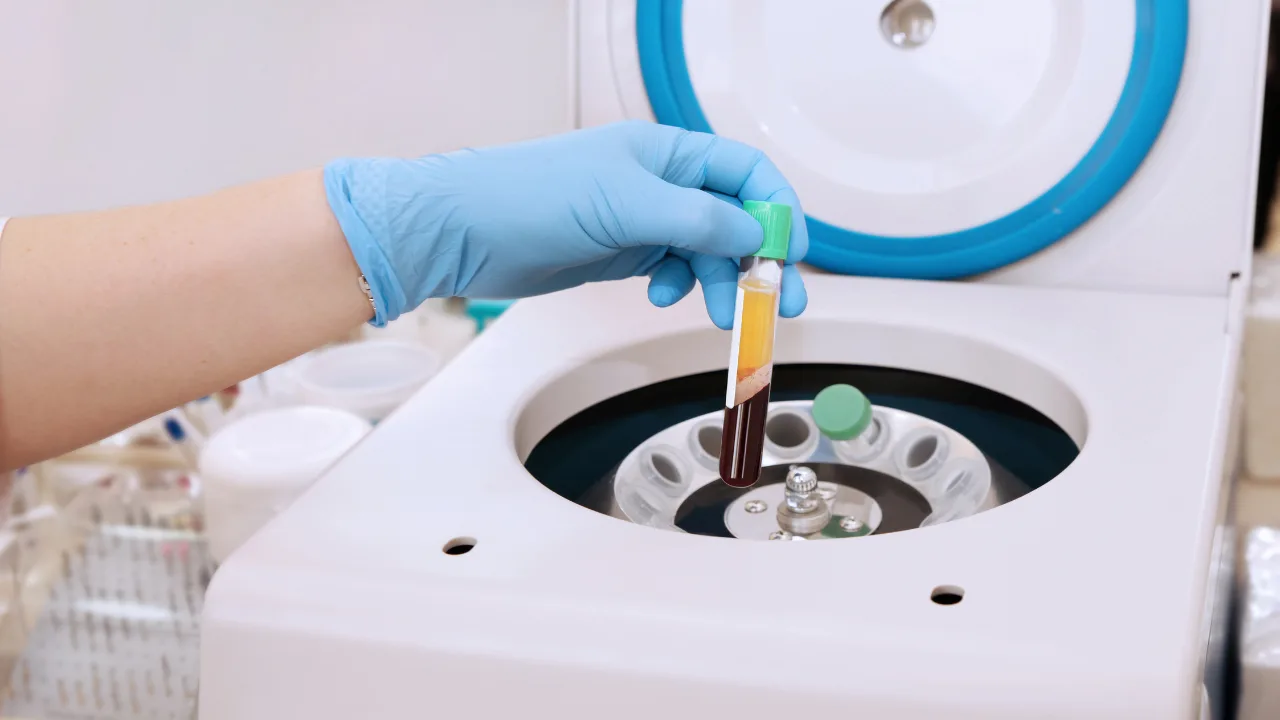 médecine régénérative cheveux