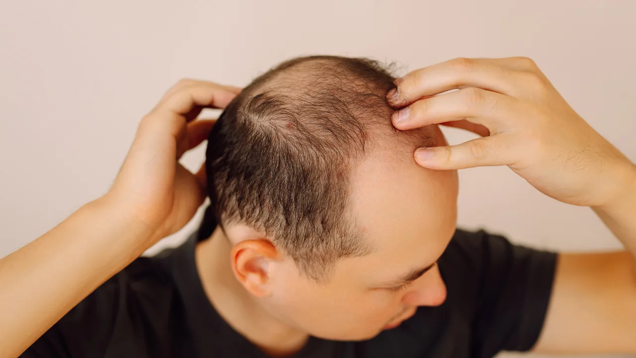 cheveux mouillés perte