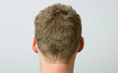 Comment photographier ses cheveux pour un diagnostic en ligne efficace ?